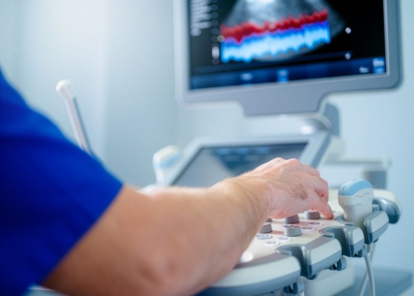 Lo schermo dell’ecografo con l’ecocolordoppler di un’arteria carotide