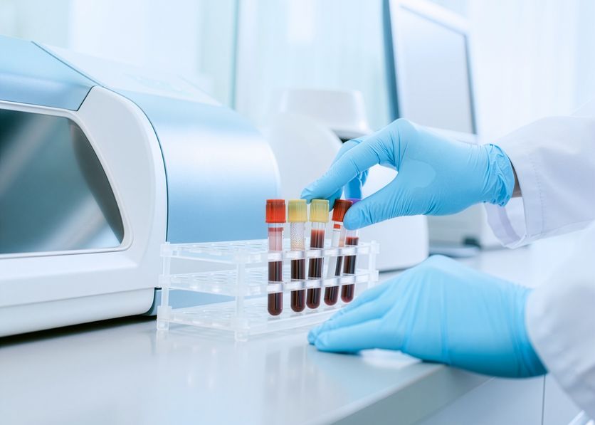 Le provette del prelievo pronte per l’analisi del profilo lipidico in laboratorio